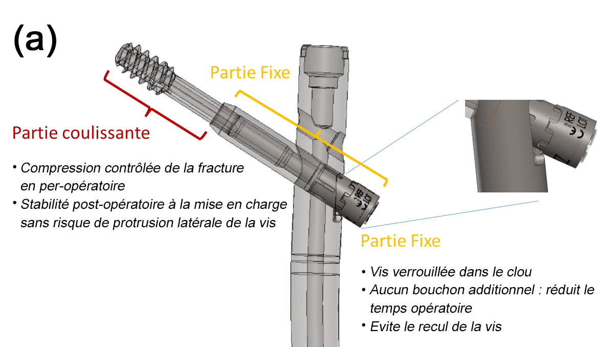 chimaera reduction douleur